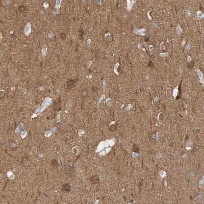 Immunohistochemistry-Paraffin: IPPK Antibody [NBP1-86712]