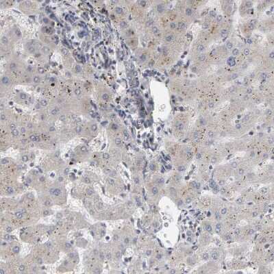 Immunohistochemistry-Paraffin: IPPK Antibody [NBP1-86712]