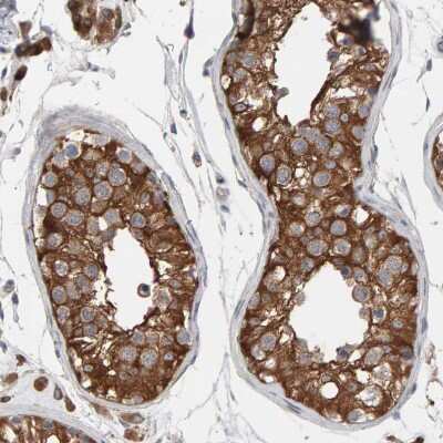 Immunohistochemistry-Paraffin: IPPK Antibody [NBP1-86712]