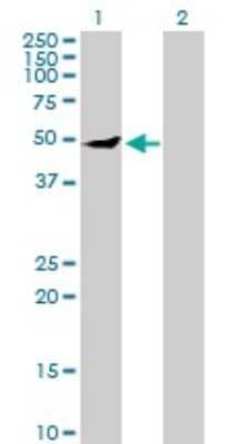 Western Blot: IPPK Antibody [H00064768-B01P]