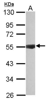 Western Blot: IPPK Antibody [NBP2-16985]