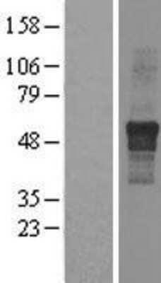 Western Blot: IPPK Overexpression Lysate [NBL1-12018]