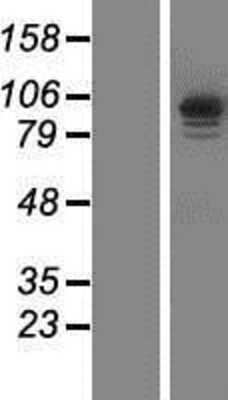 Western Blot: IQCA1 Overexpression Lysate [NBP2-06294]