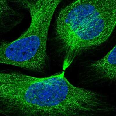 Immunocytochemistry/ Immunofluorescence: IQCB1 Antibody [NBP2-14126]