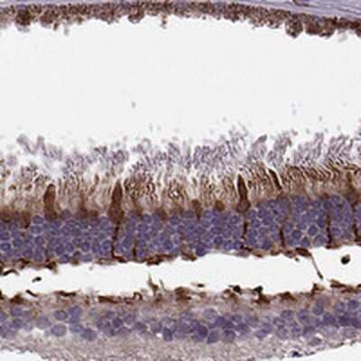 Immunohistochemistry-Paraffin: IQCB1 Antibody [NBP2-14126]