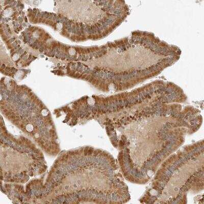 Immunohistochemistry-Paraffin: IQCC Antibody [NBP1-83852]