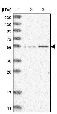 Western Blot: IQCC Antibody [NBP1-83851]