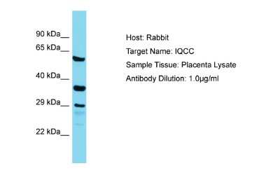 Western Blot: IQCC Antibody [NBP2-85100]