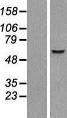 Western Blot: IQCC Overexpression Lysate [NBP2-06868]