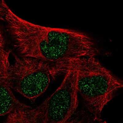 Immunocytochemistry/ Immunofluorescence: IQCD Antibody [NBP2-48916]