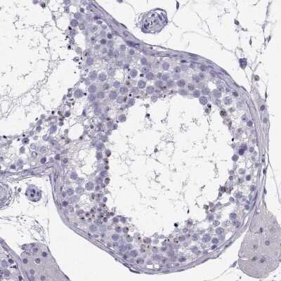 Immunohistochemistry-Paraffin: IQCD Antibody [NBP2-48859]