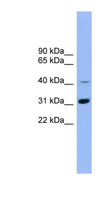 Western Blot: IQCD Antibody [NBP1-56941]