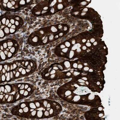 Immunohistochemistry-Paraffin: IQCE Antibody [NBP1-81447]