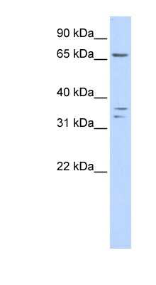 Western Blot: IQCE Antibody [NBP1-79590]