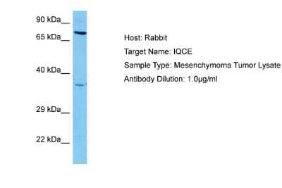 Western Blot: IQCE Antibody [NBP2-85101]