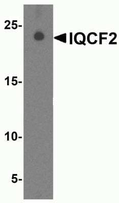 Western Blot: IQCF2 AntibodyBSA Free [NBP2-81922]