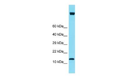 Western Blot: IQCF6 Antibody [NBP3-09738]