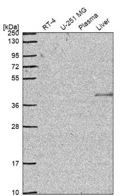 Western Blot: IQCG Antibody [NBP2-62622]