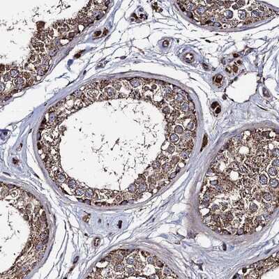Immunohistochemistry-Paraffin: IQCH Antibody [NBP1-82300]