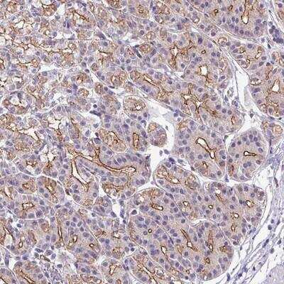 Immunohistochemistry-Paraffin: IQCJ Antibody [NBP2-14773]