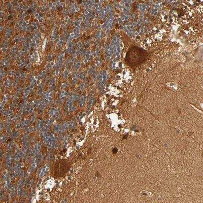 Immunohistochemistry: IQCJ-SCHIP1 Antibody [NBP1-90953]