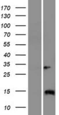 Western Blot: IQCJ Overexpression Lysate [NBP2-10664]