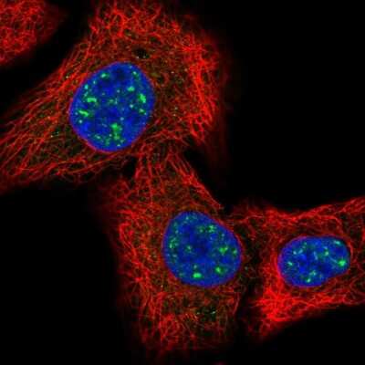 Immunocytochemistry/ Immunofluorescence: IQCK Antibody [NBP2-58411]