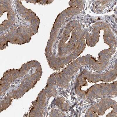 Immunohistochemistry-Paraffin: IQCK Antibody [NBP1-83486]