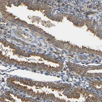 Immunohistochemistry-Paraffin: IQGAP1 Antibody [NBP1-83143]