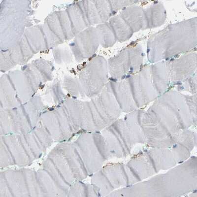Immunohistochemistry-Paraffin: IQGAP1 Antibody [NBP1-83143]