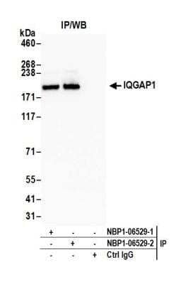 Immunoprecipitation: IQGAP1 Antibody [NBP1-06529]