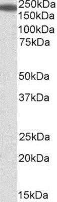 Western Blot: IQGAP1 Antibody [NBP1-51980]