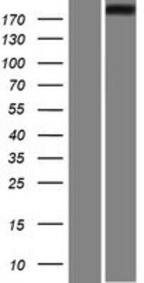 Western Blot: IQGAP1 Overexpression Lysate [NBP2-07941]