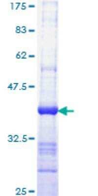 SDS-PAGE: Recombinant Human IQGAP1 GST (N-Term) Protein [H00008826-Q01]