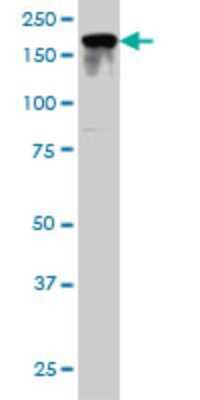 Western Blot: IQGAP2 Antibody (1B10) [H00010788-M01]