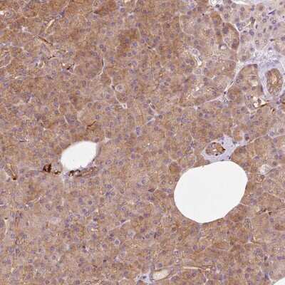 Immunohistochemistry: IQGAP2 Antibody [NBP2-37884]