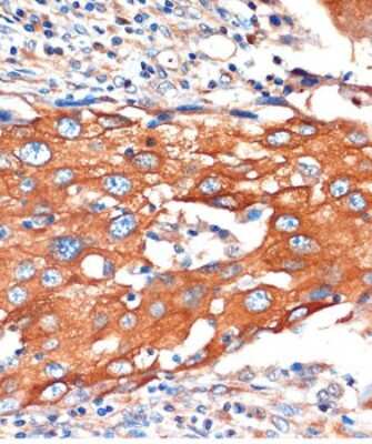 Immunohistochemistry-Paraffin: IQGAP2 Antibody - Azide and BSA Free [NBP3-04682]