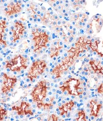 Immunohistochemistry-Paraffin: IQGAP2 Antibody - Azide and BSA Free [NBP3-04682]