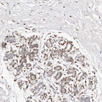 Immunohistochemistry: IQGAP3 Antibody [NBP1-86342]