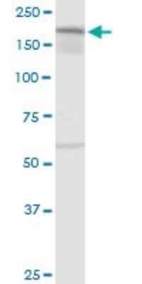 Western Blot: IQGAP3 Antibody [H00128239-D01P]