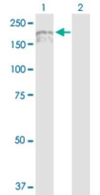 Western Blot: IQGAP3 Antibody [H00128239-D01P]