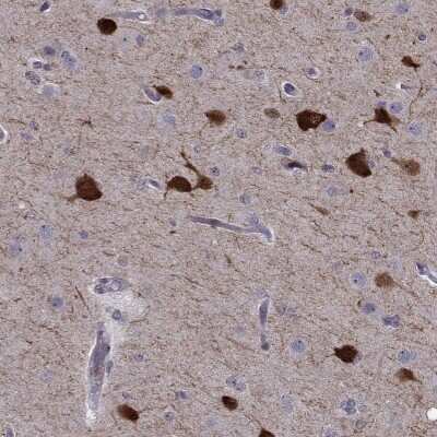 Immunohistochemistry-Paraffin: IQM1 Antibody [NBP2-55498]