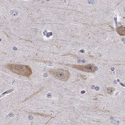 Immunohistochemistry-Paraffin: IQM1 Antibody [NBP2-55498]