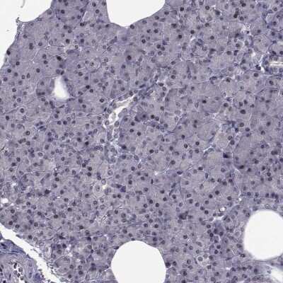 Immunohistochemistry-Paraffin: IQM1 Antibody [NBP2-55498]
