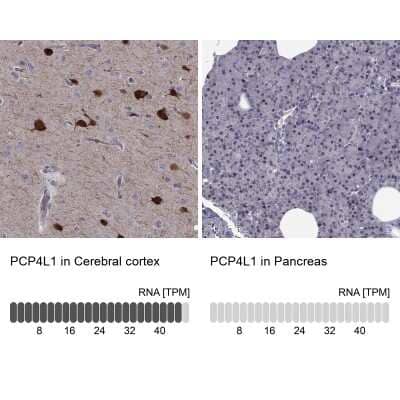 Immunohistochemistry-Paraffin: IQM1 Antibody [NBP2-55498]