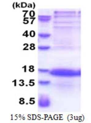 SDS-PAGE: Recombinant Human IQM1 His Protein [NBP2-23387]