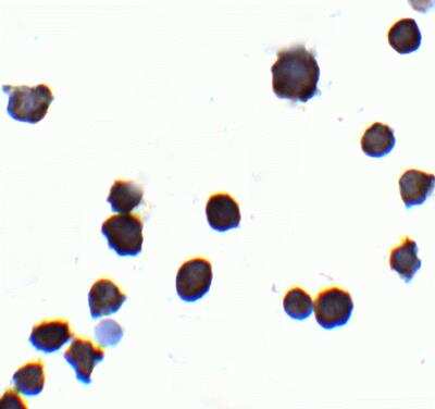 Immunocytochemistry/ Immunofluorescence: IQSEC1 Antibody - BSA Free [NBP2-81958]