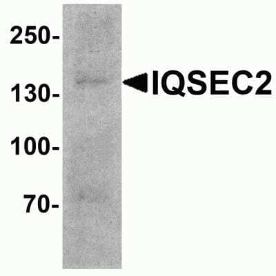 Western Blot: IQSEC2 AntibodyBSA Free [NBP2-81723]