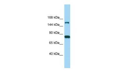 Western Blot: IQSEC2 Antibody [NBP2-84099]