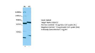 Western Blot: IQSEC2 Antibody [NBP2-84099]
